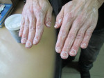 Средства для индивидуальной защиты кожи рук ЖИДКИЕ ПЕРЧАТКИ